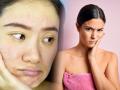 Skin care tips : चेहरा निस्तेज, बेजान, एकदम डल दिसतोय? चेहऱ्यावर ग्लो आणण्यासाठी झटपट करा ३ उपाय... - Marathi News | Skin care tips Does the face look dull, lifeless, dull? Instant 3 remedies to make your face glow ... | Latest sakhi News at Lokmat.com