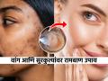 काळे डाग- पिंपल्स- सुरकुत्या होतील कमी! रोज रात्री चेहऱ्यावर लावा होममेड जायफळाचं क्रीम, चेहरा दिसेल स्पॉटलेस - Marathi News | Homemade Nutmeg Face Cream Jayphal Face Cream Get Rid of Dark Spots Anti-Aging Face Cream at Home Clear Skin Tips | Latest sakhi News at Lokmat.com