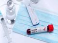 Coronavirus: कोरोना चाचणीच्या किटची मागणी वाढली; संक्रमित असूनही सरकारला कुणी सांगेना - Marathi News | Coronavirus: increased demand for corona test kits after ICMR new guideline | Latest national News at Lokmat.com