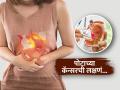 आंबट-करपट ढेकर आणि छातीत सतत जळजळ, पोटाच्या कॅन्सरचीही असू शकतात लक्षणं-वेळीच तपासा - Marathi News | Stomach Cancer Sign : Acidity and sour burps can be early signs of stomach cancer | Latest sakhi News at Lokmat.com