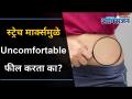 स्ट्रेच मार्क्स मुळे चारचौघात वाटते लाज? Worried of Stretch Marks Because of Weight Gain? - Marathi News | Feeling ashamed because of stretch marks? Worried of Stretch Marks Because of Weight Gain? | Latest oxygen Videos at Lokmat.com