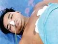 ...अन् आतडी बाहेर येऊनही तो ९ किमी चालला - Marathi News | Man Falls From Train In Telangana Walks 9 Km With His intestine Out | Latest national News at Lokmat.com