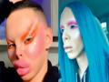 एलियन होण्यासाठी केल्या शंभर शस्त्रक्रिया - Marathi News | Hundreds of surgeries performed to become aliens | Latest jarahatke News at Lokmat.com