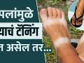 पायांवर चपलांमुळे टॅनिंग झालं आहे का | How to Remove Tan From Legs at Home | How to Remove Sun tan - Marathi News | Is there any tanning on the feet due to slippers? How to Remove Tan From Legs at Home | How to Remove Sun tan | Latest health Videos at Lokmat.com