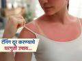 उन्हाळ्यात टॅनिंगमुळे काळपट दिसू लागली त्वचा? 'या' घरगुती उपायांनी त्वचा पुन्हा उजळेल... - Marathi News | Home remedies to get rid of tanning in summer naturally | Latest sakhi News at Lokmat.com