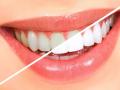 दात पांढरे शुभ्र आणि चमकदार करण्यासाठी करा ही ४ कामे! - Marathi News | 4 ways to whiten your teeth at home | Latest beauty News at Lokmat.com