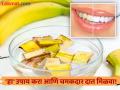पिवळ्या दातांना वैतागलात, केळीच्या सालीत 'ही' एक गोष्ट मिक्स करून लावा; चमकदार होतील दात! - Marathi News | Use banana peel and baking soda for making teeth white at home naturally | Latest beauty News at Lokmat.com