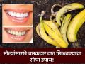 केळीची साल-मीठ-हळद आणि टूथपेस्ट, दात चमकदार करण्याचा बेस्ट उपाय; एकदा करून बघाच! - Marathi News | Banana peel effective home remedy to remove tartar and plaque from teeth | Latest sakhi News at Lokmat.com