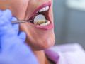 वजन कमी होत नाही म्हणून दातच शिवले, महिलेचे अजब कारनामा - Marathi News | women-sealed-her-teeth-to-reduce-weight-took-big-risk-with-her-teeth | Latest social-viral News at Lokmat.com