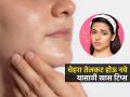तेलकट त्वचेमुळे चेहरा काळा दिसतो? होमिओपेथी डॉक्टर सांगतात १ उपाय, टॅनिंग निघेल - Marathi News | How To Remove Oil From Skin With Multani Mitti Face Pack By Homeopathy Doctor Raju Ram Goyal | Latest sakhi News at Lokmat.com