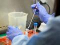 अकोला जिल्ह्यात कोरोनाचे आणखी ३४ पॉझिटिव्ह रुग्ण आढळले - Marathi News | Another 34 corona positive patients were found in Akola district | Latest akola News at Lokmat.com