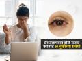 ऐन तारूण्यात डोळे होतील अधू, १० सवयींमुळे नजर होते धूसर, पाहा तुम्हाला या सवयी आहेत का? - Marathi News | 10 Habbits That Harm Your Eyes : Which 10 Habbits That Harm Your Eye Health | Latest sakhi News at Lokmat.com