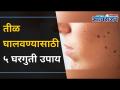 तीळ घालवण्यासाठी ५ घरगुती उपाय | How to Remove Skin Tags and Moles? | Home Remedies | Lokmat Oxygen - Marathi News | 5 Home Remedies for Mole | How to Remove Skin Tags and Moles? | Home Remedies | Lokmat Oxygen | Latest oxygen Videos at Lokmat.com