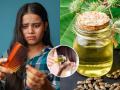 पावसाळ्यात होणारी केसगळती थांबवणारं जादुई तेल! एरंडेल तेलात मिसळा २ पदार्थ - केस व स्काल्प राहील निरोगी... - Marathi News | Monsoon Hair Care Tips Healthy Hair Monsoon What to mix in castor oil to stop hair fall during monsoon season Stop hair fall monsoon Ayurvedic hair remedies | Latest sakhi News at Lokmat.com