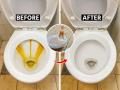 कितीही घासलं तरी टॉयलेट काळेकुट्ट- पिवळे दिसते? सोपी ट्रिक- टॉयलेट होईल स्वच्छ - दुर्गंधीही गायब - Marathi News | How to remove hard yellow stains from toilet bowl naturally Best home remedies to make toilet smell fresh Easy tricks to clean dirty toilet without chemicals | Latest sakhi News at Lokmat.com