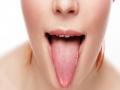 जिभेच्या रंगावरून ओळखा तुम्हाला कोणता आजार झालाय - Marathi News | Know What your tongue says about your health | Latest health News at Lokmat.com