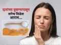 दाताच्या दुखण्यानं खाणं-पिणं झालं अवघड? करा 'हे' सोपे उपाय, त्रास होईल कमी - Marathi News | How to stop tooth pain use these simple home remedies | Latest sakhi News at Lokmat.com