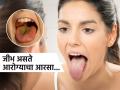 जिभेचा रंग बदलणं हा आजार की मोठ्या आजाराचं लक्षणं? एक्सपर्टनी सांगितलं, रंग बदलला तर.. - Marathi News | What to do if you see yellow or red marks on your tongue | Latest sakhi News at Lokmat.com