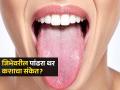 जिभेवरचा पांढरा किंवा पिवळ्या रंगाचा थर कशाचं लक्षणं? पाहा कशाने जिभ दिसते खराब - Marathi News | What your tongue color tells you about the health | Latest sakhi News at Lokmat.com
