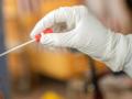 चाचण्यांचे प्रमाण ‘जैसे थे’: रुग्णसंख्या वाढीचा वेग मंदावला - Marathi News | Tests 'as is': patient growth slows in Akola district | Latest akola News at Lokmat.com