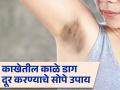 काखेतील काळे डाग दूर करण्याचे सोपे घरगुती उपाय, लगेच दिसेल फरक! - Marathi News | Get rid of dark spots in underarm with these home remedies | Latest health News at Lokmat.com