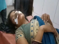 UP Crime: धक्कादायक! पत्नी माहेरी गेल्याने पती नाराज, मारहाण करत पत्नीच्या नाकाचे तोडले लचके - Marathi News | UP Crime: angry husband bites wife's nose and beat her, police filed FIR | Latest national News at Lokmat.com