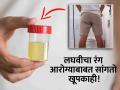 लघवीचा रंग बदलणं कधी असते धोक्याची घंटा? जाणून घ्या कसा रंग दिसल्यावर वाढू शकते चिंता! - Marathi News | Urine colour change dangerous effects, symptoms risk disease | Latest health News at Lokmat.com