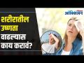 शरीरातील उष्णता वाढल्यास काय करावं? | What to do if body heat rises? | Lokmat Oxygen | - Marathi News | What to do if body heat rises? | What to do if body heat rises? | Lokmat Oxygen | | Latest health Videos at Lokmat.com