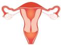 ३५ वर्षांच्या आतील महिलेचे गर्भाशय काढण्यावर निर्बंध - Marathi News | Restrictions on uterus removal for a woman within 5 years | Latest beed News at Lokmat.com