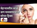 चेहऱ्यावरील काळे डाग घालवण्यासाठी सोप्या ट्रिक्स | Remove Dark Spots & Dark Circle Naturally - Marathi News | Simple tricks to get rid of dark spots on the face Remove Dark Spots & Dark Circle Naturally | Latest oxygen Videos at Lokmat.com