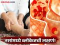 नसांमध्ये ब्लॉकेज झाल्यावर दिसतात 'हे' ५ संकेत, वेळीच घ्या डॉक्टरांचा सल्ला!  - Marathi News | 5 signs seen in the body indicate blockage in vein | Latest health News at Lokmat.com