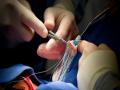  रुग्णाशी बोलता-बोलता केले जाते हृदयाचे ‘व्हॉल्व्ह रिप्लेसमेंट’ - Marathi News | Heart valve replacement is done in consultation with the patient. | Latest nagpur News at Lokmat.com