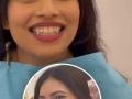 सुळे खायचे की दाखवायचे! पाहा दुबईच्या तरुणीचे लांबलचक Vampire Teeth, नकली दात लावून घेण्याचा खतरनाक ट्रेंड - Marathi News | How to get vampire teeth temporarily how to make diy vampire fangs | Latest sakhi News at Lokmat.com