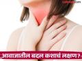 आजाराची अबोल भाषा: आवाजातील बदल हे ईएनटी समस्यांचे प्राथमिक लक्षण असू शकते का? - Marathi News | The silent language of illness: Can voice changes be an early sign of ENT problems? | Latest health News at Lokmat.com