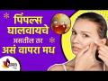 चेहऱ्यावरील पिंपल्ससाठी मधाचा घरगुती रामबाण उपाय | Benefits of Honey for pimples | Pimples Remover - Marathi News | Honey Home Remedy for Facial Pimples | Benefits of Honey for pimples | Pimples Remover | Latest sakhi Videos at Lokmat.com