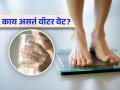 शरीरात जमा पाण्याने वाढू शकतं तुमचं वजन, जाणून घ्या कसं कमी कराल वॉटर वेट! - Marathi News | What is water weight and how to reduce it effectively know tips here | Latest sakhi News at Lokmat.com