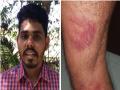 फक्त प्रश्न विचारला म्हणून तरुणाला पोलिसांची अमानुष मारहाण - Marathi News | youth beaten by police because he asked the question | Latest maharashtra Videos at Lokmat.com