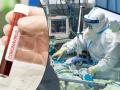 Coronavirus: धोकादायक! जाणून घ्या, १ कोरोना रुग्ण किती जणांना बनवतो शिकार? डॉक्टरांनी दिला आकडा - Marathi News | Coronavirus: Dangerous! 1 corona patients impact on 59 thousand peoples pnm | Latest health Photos at Lokmat.com
