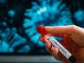 Coronavirus: धक्कादायक! तुम्हालाही असू शकते कोरोनाची लागण; ‘फॉल्स निगेटिव्ह’ रुग्णांनी वाढवली चिंता - Marathi News | Coronavirus:You may also have corona infections; 'False negative' patients raise concerns pnm | Latest international Photos at Lokmat.com