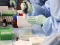 Coronavirus: ‘या’ प्राण्याच्या रक्तापासून बनू शकते कोरोनाची लस; वैज्ञानिकांचा दावा - Marathi News | Coronavirus: Corona vaccine can be made from the blood of this llamas; Scientists claim pnm | Latest international Photos at Lokmat.com