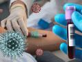 CoronaVirus News : 'प्लाझ्मा दान करा आणि 5000 मिळवा'; 'या' सरकारने घेतला मोठा निर्णय - Marathi News | CoronaVirus Marathi News karnataka government give 5000 those donate plasma | Latest national News at Lokmat.com
