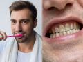 Brushing Tips: रोज दात घासूनही पिवळेच दिसतात? मग वेळीच जाणून घ्या योग्य पद्धत, दुर्गंधीसुद्धा होईल दूर - Marathi News | Brushing Tips: What is the right way to brush your teeth how many minutes of brushing is sufficient | Latest health News at Lokmat.com
