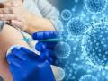 CoronaVirus News : लस घेण्याआधी किंवा पहिला डोस घेतल्यानंतर चाचणी पॉझिटिव्ह आली तर? तज्ज्ञ म्हणाले की..... - Marathi News | CoronaVirus News : Coronavirus can you get vaccinated if you have covid-19 doctors explain | Latest health News at Lokmat.com