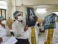 CoronaVirus Live Updates : बापरे! कोरोनाने चिमुकल्याचं 90% फुफ्फुस झालं खराब पण तरीही टेस्ट निगेटिव्ह; डॉक्टरही हैराण  - Marathi News | CoronaVirus Live Updates challenge for doctors 8 year child corona case 90 percent lungs failure but test negative | Latest national News at Lokmat.com