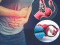 PCOD & PCOS: PCOS मध्ये फर्टिलिटीवर तर PCOD मध्ये पिरिएड्सवर 'असा' होतो परिणाम; जाणून घ्या लक्षणं अन् फरक - Marathi News | PCOD & PCOS : What is difference between pcos or pcod and know which is more dangerous for women | Latest sakhi News at Lokmat.com