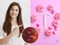बर्थ कंट्रोलसाठी उत्तम पर्याय ठरतंय IUD; वाचा प्रकार, वापराची पद्धत अन् फायदे - Marathi News | IUD birth control : IUD best birth control option for women and know its types | Latest sakhi News at Lokmat.com