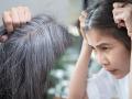 White hair : डोक्यावरचे पांढरे केस दिवसेंदिवस वाढताहेत? मग काळ्या, दाट केसांसाठी 'हे' घ्या घरगुती उपाय - Marathi News | White hair : White hair problem solution know here home remedies for dark hair | Latest sakhi News at Lokmat.com