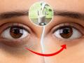 How to remove Dark circles : दुधाच्या वापरानं डोळ्यांखालची काळी वर्तुळं कायमची घालवा; काही मिनिटात दिसेल ग्लोईंग चेहरा - Marathi News | How to remove Dark circles faster : Home remedies for remove dark circles faster | Latest sakhi News at Lokmat.com