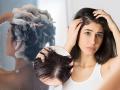 केसांचा चिकटा? कितीही शाम्पू करा, केस चिकट-चिप्पू चिप्पू दिसतात? करा हे ४ सोपे उपाय - Marathi News | Sticky hair? No matter how much you shampoo, does the hair look sticky? Here are 4 easy solutions | Latest sakhi News at Lokmat.com