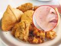 How to remove pimples : तेलकट पदार्थं खाल्ल्यानं चेहऱ्यावर पिंपल्स येतात? अंगावर खाजही येते? जाणून घ्या खरंच असं होतं का - Marathi News | How to remove pimples : Can oily food cause pimples on face | Latest sakhi News at Lokmat.com